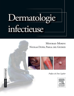 Dermatologie infectieuse Dermatologie infectieuse