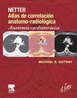 Netter. Atlas de correlación anatomo-radiológica: Anatomía cardiotorácica Netter. Atlas de correlación anatomo-radiológica: Anatomía cardiotorácica