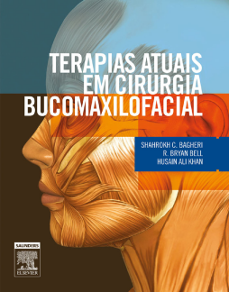 Terapias Atuais em Cirurgia Bucomaxilofacial Terapias Atuais em Cirurgia Bucomaxilofacial