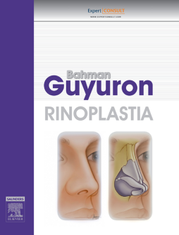 Rinoplastia Rinoplastia