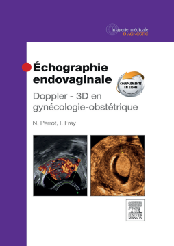 Échographie endovaginale Doppler - 3D Échographie endovaginale Doppler - 3D