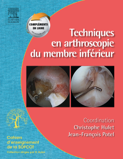 Techniques en arthroscopie du membre inférieur Techniques en arthroscopie du membre inférieur