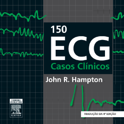 150 ECG Casos Clinicos