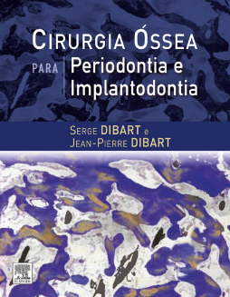 Cirurgia Óssea para Periodontia e Implantodontia Cirurgia Óssea para Periodontia e Implantodontia