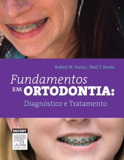 Fundamentos em Ortodontia: Diagnóstico e Tratamento Fundamentos em Ortodontia: Diagnóstico e Tratamento