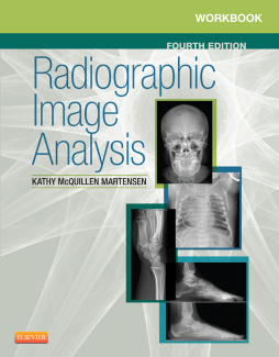 Workbook for Radiographic Image Analysis - E-Book Workbook for Radiographic Image Analysis - E-Book
