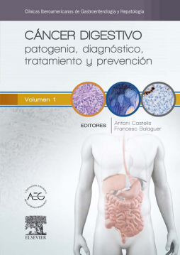 Cáncer digestivo: patogenia, diagnóstico, tratamiento y prevención Cáncer digestivo: patogenia, diagnóstico, tratamiento y prevención