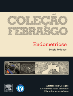 Endometriose Endometriose