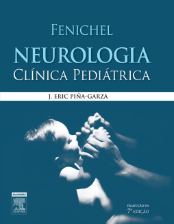 Fenichel Neurologia Clínca Pediátrica Fenichel Neurologia Clínca Pediátrica