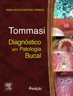 Diagnóstico em Patologia Bucal Diagnóstico em Patologia Bucal