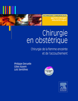 Chirurgie en obstétrique Chirurgie en obstétrique