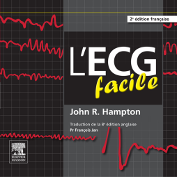 L'ECG facile L'ECG facile