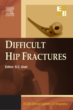 ECAB Difficult Hip Fracture - E-Book ECAB Difficult Hip Fracture - E-Book