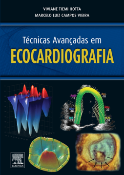 Técnicas Avançadas em Ecocardiografia Técnicas Avançadas em Ecocardiografia