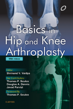 Basics in Hip and Knee Arthroplasty - E-book Basics in Hip and Knee Arthroplasty - E-book