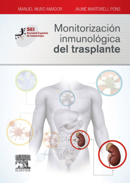 Monitorización inmunológica del trasplante Monitorización inmunológica del trasplante