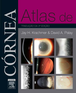 Atlas de Córnea Atlas de Córnea