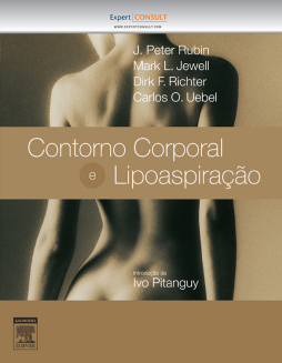 Contorno Corporal e Lipoaspiração Contorno Corporal e Lipoaspiração