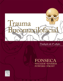 Trauma Bucomaxilofacial Trauma Bucomaxilofacial