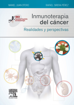 Inmunoterapia del cáncer. Realidades y perspectivas Inmunoterapia del cáncer. Realidades y perspectivas