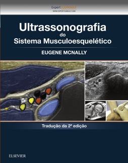 Ultrassonografia do Sistema Musculoesquelético Ultrassonografia do Sistema Musculoesquelético