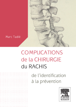 Complications de la chirurgie du rachis Complications de la chirurgie du rachis