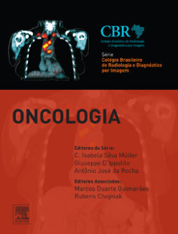 CBR - Oncologia CBR - Oncologia