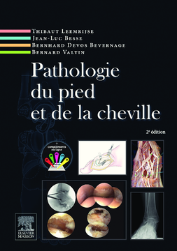 Pathologie du pied et de la cheville Pathologie du pied et de la cheville