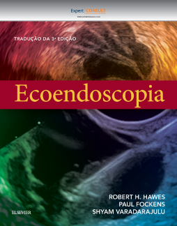 Ecoendoscopia Ecoendoscopia