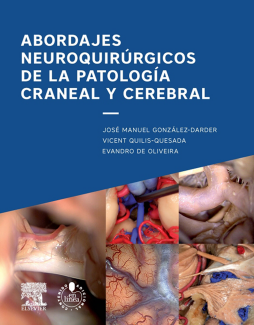 Abordajes neuroquirúrgicos de la patología craneal y cerebral + acceso web Abordajes neuroquirúrgicos de la patología craneal y cerebral + acceso web