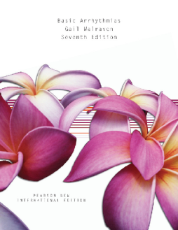 Basic Arrhythmias: Pearson New International Edition Basic Arrhythmias: Pearson New International Edition