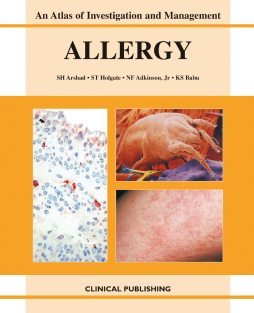 Allergy: an Atlas of Investigation and Management Allergy: an Atlas of Investigation and Management