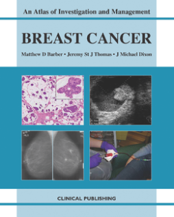 Breast Cancer: an Atlas of Investigation and Management