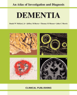 Dementia: an Atlas of Investigation and Diagnosis