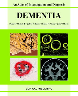 Dementia: an Atlas of Investigation and Diagnosis Dementia: an Atlas of Investigation and Diagnosis