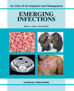 Emerging Infections: an Atlas of Investigation and Management Emerging Infections: an Atlas of Investigation and Management