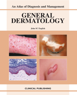 General Dermatology: an Atlas of Investigation and Diagnosis General Dermatology: an Atlas of Investigation and Diagnosis