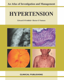 Hypertension: An Atlas of Investigation and Management