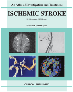 Ischemic Stroke: an Atlas of Investigation and Diagnosis