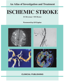 Ischemic Stroke: an Atlas of Investigation and Diagnosis Ischemic Stroke: an Atlas of Investigation and Diagnosis