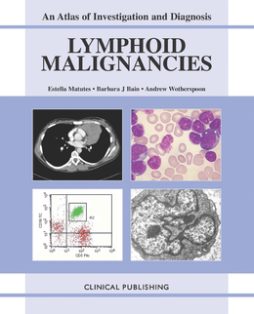 Lymphoid Malignancies: an Atlas of Investigation and Diagnosis