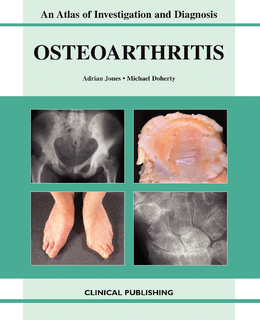 Osteoarthritis: Atlas of Investigation Diagnosis and Management