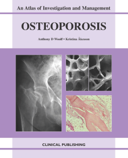 Osteoporosis: an Atlas of Investigation and Management