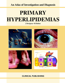 Primary Hyperlipidemias: an Atlas of Investigation and Diagnosis Primary Hyperlipidemias: an Atlas of Investigation and Diagnosis