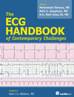 The ECG Handbook of Contemporary Challenges The ECG Handbook of Contemporary Challenges
