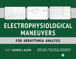 Electrophysiological Maneuvers for Arrhythmia Analysis Electrophysiological Maneuvers for Arrhythmia Analysis
