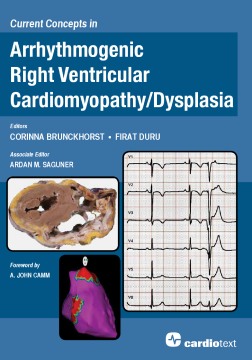 Current Concepts in Arrhythmogenic Right Ventricular Cardiomyopathy/Dysplasia