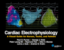 Cardiac Electrophysiology: A Visual Guide for Nurses, Techs, and Fellows