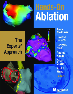 Hands-On Ablation: The Experts' Approach Hands-On Ablation: The Experts' Approach