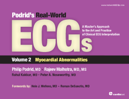 Podrid's Real-World ECGs: Volume 2, Myocardial Abnormalities Podrid's Real-World ECGs: Volume 2, Myocardial Abnormalities